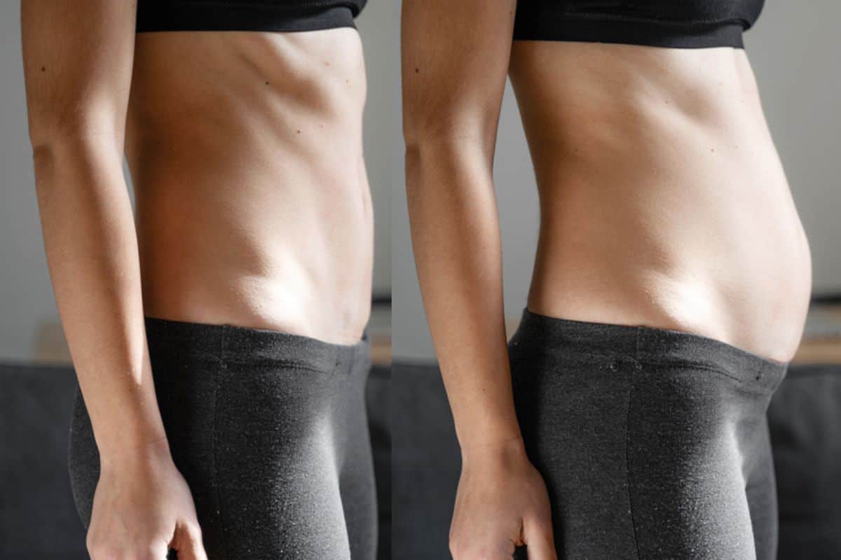 How long does diastasis recti take to improve Cheltenham?