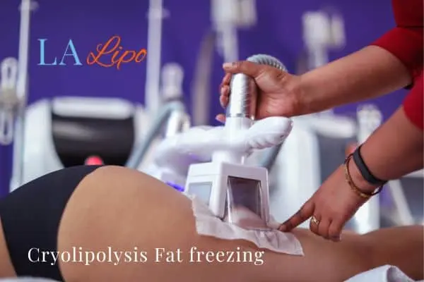 women getting fat freezing Cheltenham