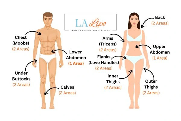 LA LIPO Cryolipolysis Areas Cheltenham