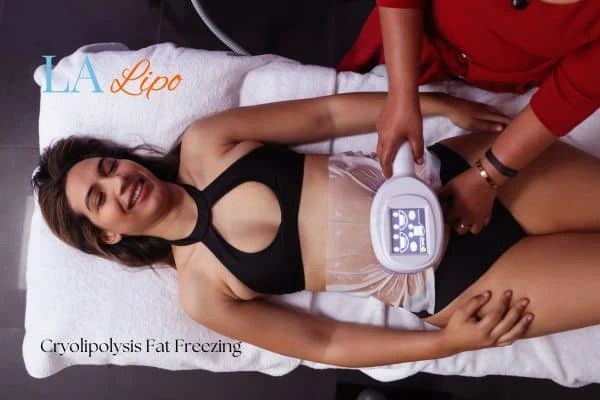 woman getting cryolipolysis Cheltenham