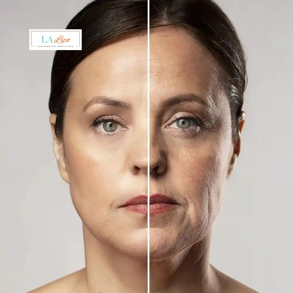 How Can You Tell If Non-Surgical Skin Tightening Is Right for You Cheltenham?