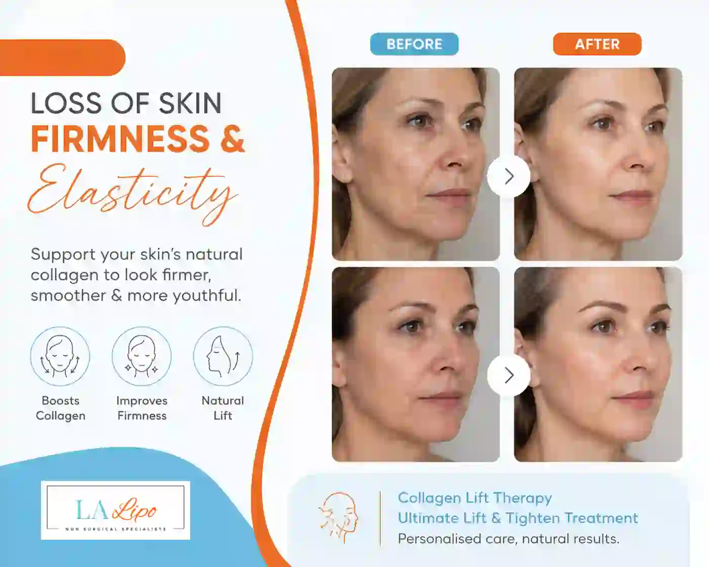 Sign #7: Loss of Skin Firmness and Elasticity Cheltenham